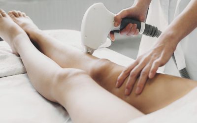 Epilazione Laser a Diodo 808 nm: La Soluzione Definitiva per Dire Addio ai Peli Superflui