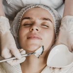 Chemisches Peeling