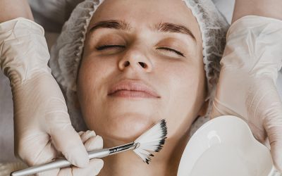 Peeling Chimico: Rivela la Bellezza Nascosta della Pelle